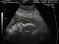 miguel licero garrido   3d ultrasound