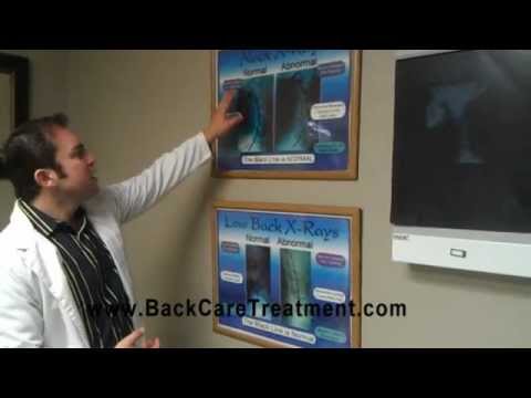 how to get rid numbness