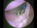 Inside my shoulder (Doc's voice clearer)