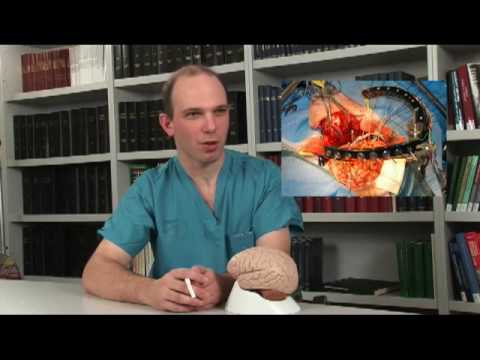An Overview of Brain Surgery and the Current Understanding of Brain Function