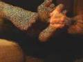 MIGRAÑA / DOLOR DE CABEZA (CRONICO)
