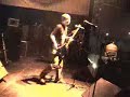 EPILEPSIA-REGRESO-A-