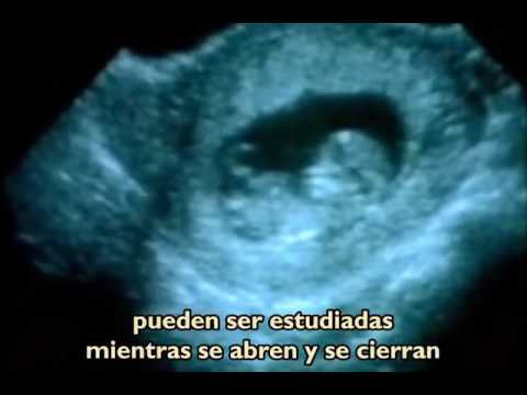 Videos-De-Abortos-Reales de abortos reales - Videos | Videos relacionados con youtube.videos de ...
