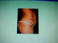 videos de لقاء مع الدكتور كمال حسين صالح اختصاصي تجميل على تلفزيون قطر