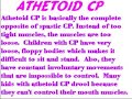 Cerebral Palsy