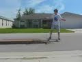 MY FRIENDS SKATEBOARDING FALL...BROKEN ELBOW, HEAD CONCUSION