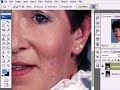 Photoshop - Removing wrinkles Photoshop - Removing wrinkles