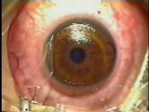 Retina - Post Mordem Productions - Retina Video.