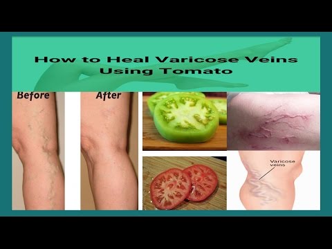 main vein meaning in urdu