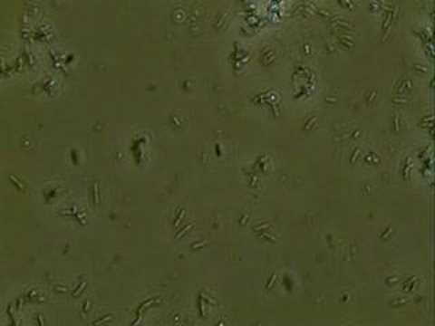 Cell Lysis