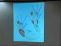 Parafunction Insight - 9