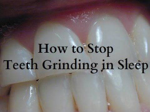 how to cure bruxism