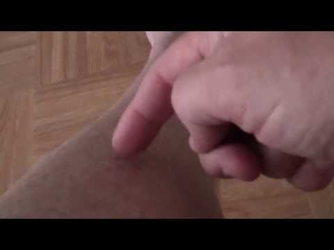 how to relieve itchy bites