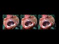 Reef - Symbiosis Reef - Symbiosis