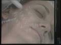 Dr Humberto: Rejuvenescimento - Sculptra