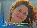 amputee