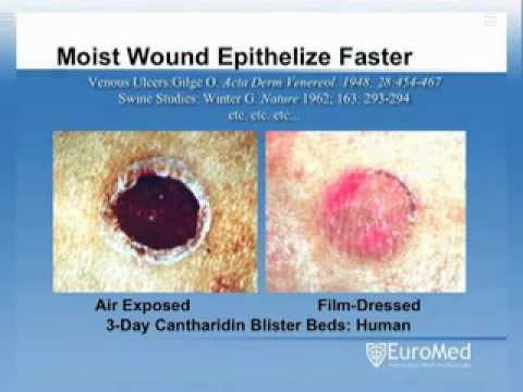 how to collect aerobic wound culture