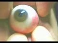 Eye Eye