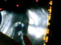 videos de Priscila en accion