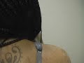 The Acne Practice (Back Acne progress report) The Acne Practice (Back Acne progress report)