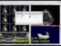 videos de Bioparts - Tutorial 3 DentalSlice: Janela 3D: parte 1 de 2