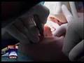 Dental Sedation @ Dental Specialties in Randolph, MA