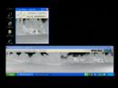 WideEYE 180degress Detection WideEYE 180degress Detection
