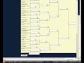 The Overbored Help View and Edit Bracket