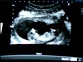 12 semanas 12 semanas