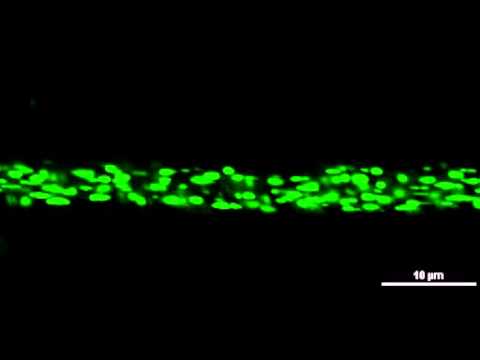 GFP-Tagged Drosophila Motor Neuron Mitochondria in an in vivo Preparation