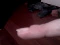 Infected finger... follow up II