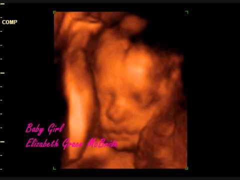 4D Ultrasound Video of Baby Elizabeth @ 27 weeks