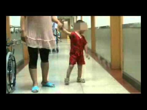 how to treat hdn