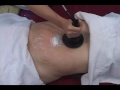 cavitation uygulama