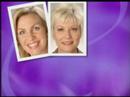 Collagen Fusion Video