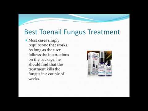 how to kill fungus in boots