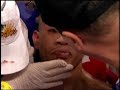 Boxing - Pacquiao Knows What He Needs To Do To Win
