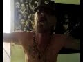 Perro rabioso... el Wachy ...