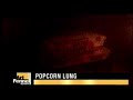 Toxic Popcorn