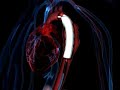 Surgeons from St. Franziskus-Hospital in Muenster, Germany will demonstrate the repair of a thoracic aortic aneurysm (TAA) with the Cook Zenith TX2® Endovascular Graft in a live webcast. The webcast, featuring the TX2's new Z-Trak Plus Introduction System, will be broadcast Tuesday, April 24th at 5 p.m. Central European time.Prof. Giovanni Torsello, Chief of the Department of Vascular Surgery at St. Franziskus-Hospital, Muenster, Germany, will discuss his performance of the case along with an international panel of European doctors who are experts in this device technology. Viewers will have the ability to email questions for inclusion in the interactive presentation.