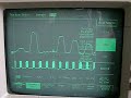 P400 waveform
