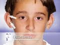 Otoplasty (Ear Pinning) at www.PearsonFaces.com