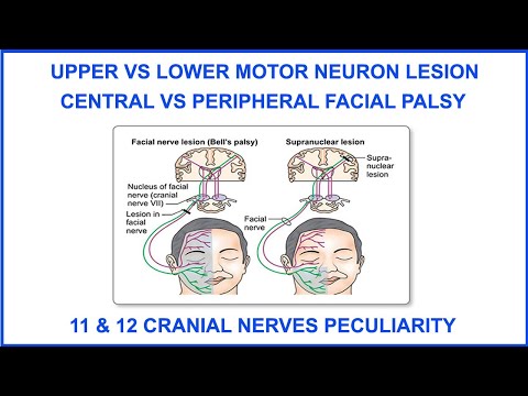 UPPER VS LOWER MOTOR NEURON LESION,CENTRAL VS PERIPHERAL FACIAL PALSY,11&12CRANIAL NERVE PECULIARITY