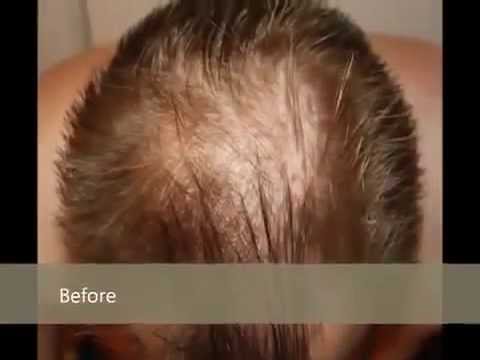 how to grow dog hair back