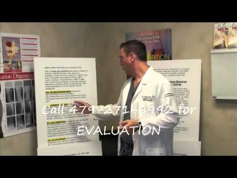 how to eliminate rls