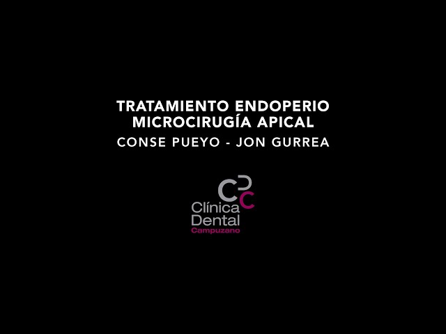 Tratamientos