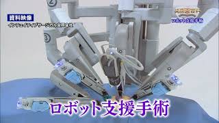 第82回　ロボット支援手術