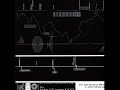 Amorphous Androgynous (Future Sound Of London) - Swab
