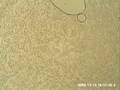 videos de Chameleon Blood Showing Live Microfilariae Parasites Part 1
