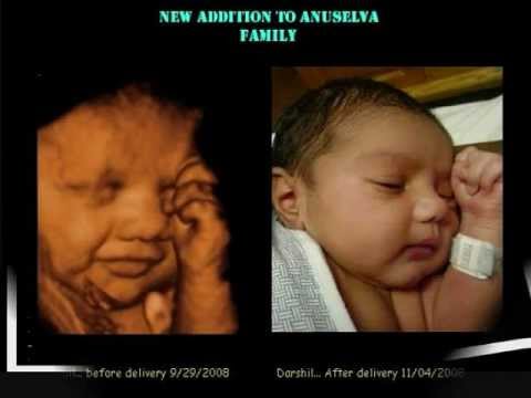 ultrasound 3d 4d - View a family experience the miracle of 3d/4d ultrasound at GoldenView Ultrasound. See amazing 3d images ( before ) compared to newborn photos (after) and se...